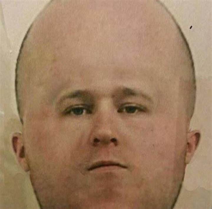 Big ol forehead r/forehead