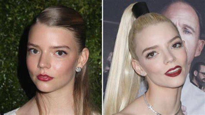 Did Anya TaylorJoy Get Plastic Surgery? Quotes, Photos Life & Style
