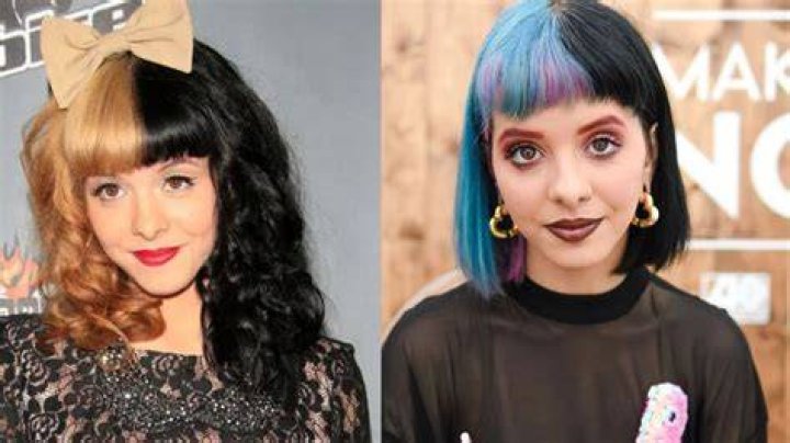 Did Melanie Martinez Get Plastic Sμrgery to Look Like a Fairy