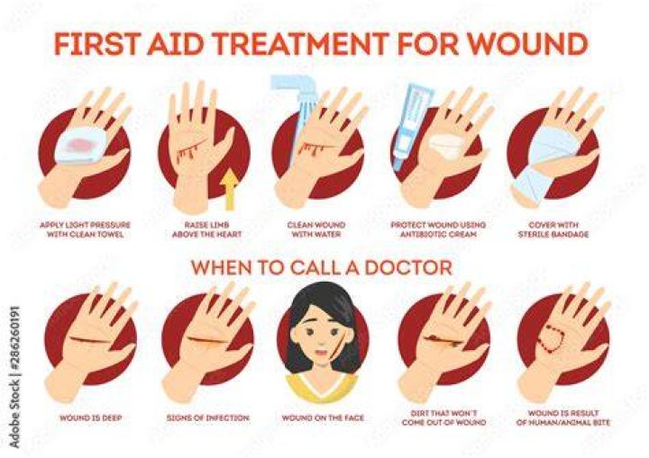 First Aid Treatment for Cuts and Grazes First Aid for Free