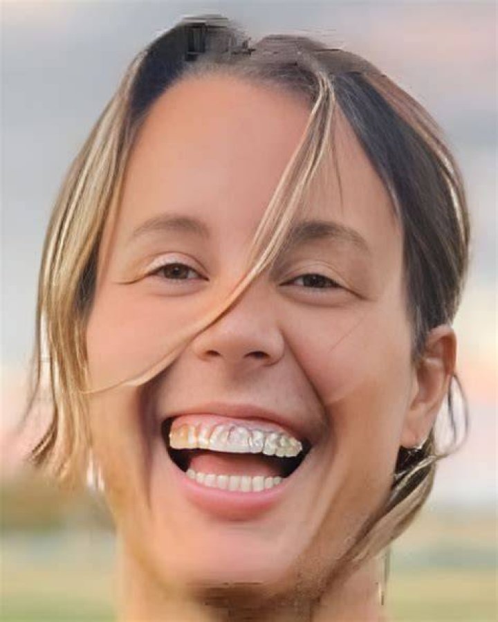 Model Kate Stoltz’s Bio Net Worth, Boyfriend, Dating Plastic Surgeon