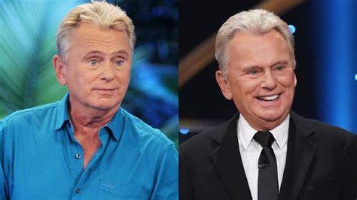 Pat Sajak Plastic Surgery Did The Host Undergo Surgery?