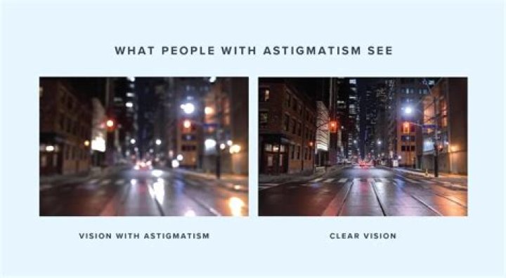 What Is Astigmatism & Everything You Need to Know &mdash; UNIQSO